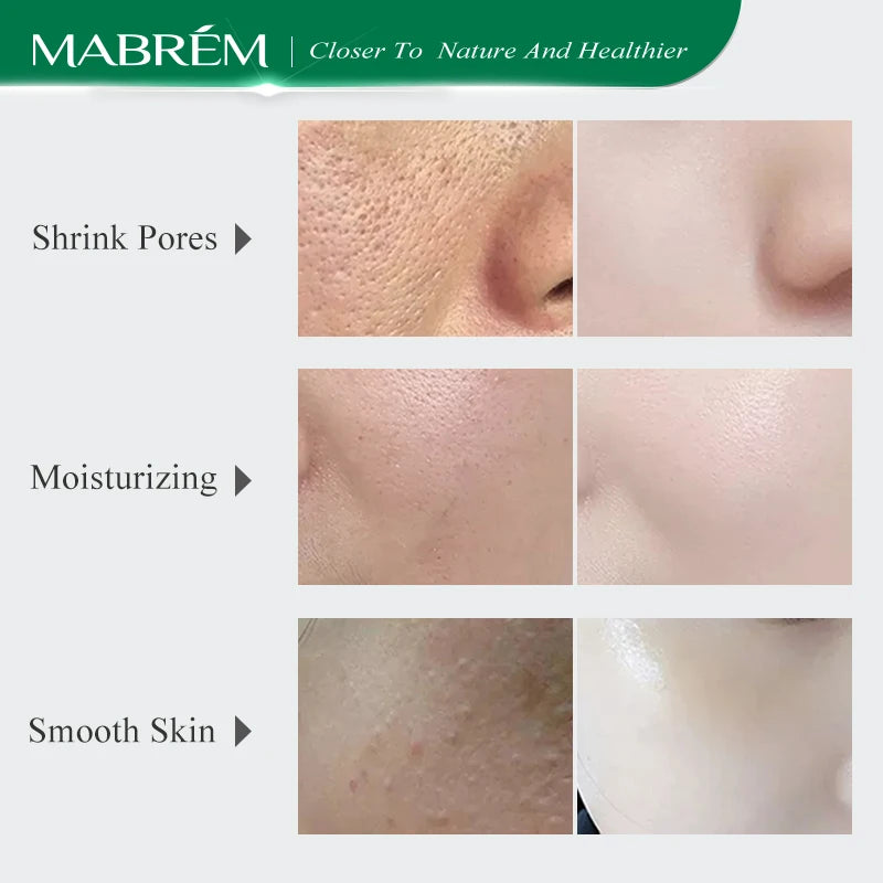 Pore Shrinking Serum Treatment Moisturizing